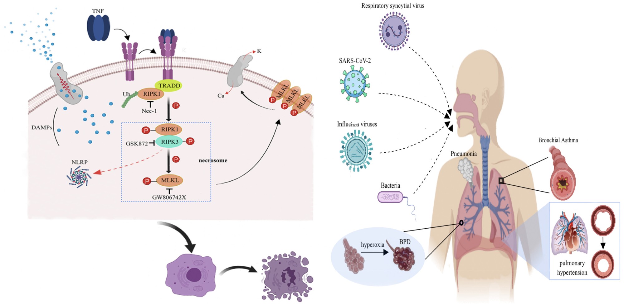 乔莉娜教授团队发表综述：The role of necroptosis in common respiratory diseases in children