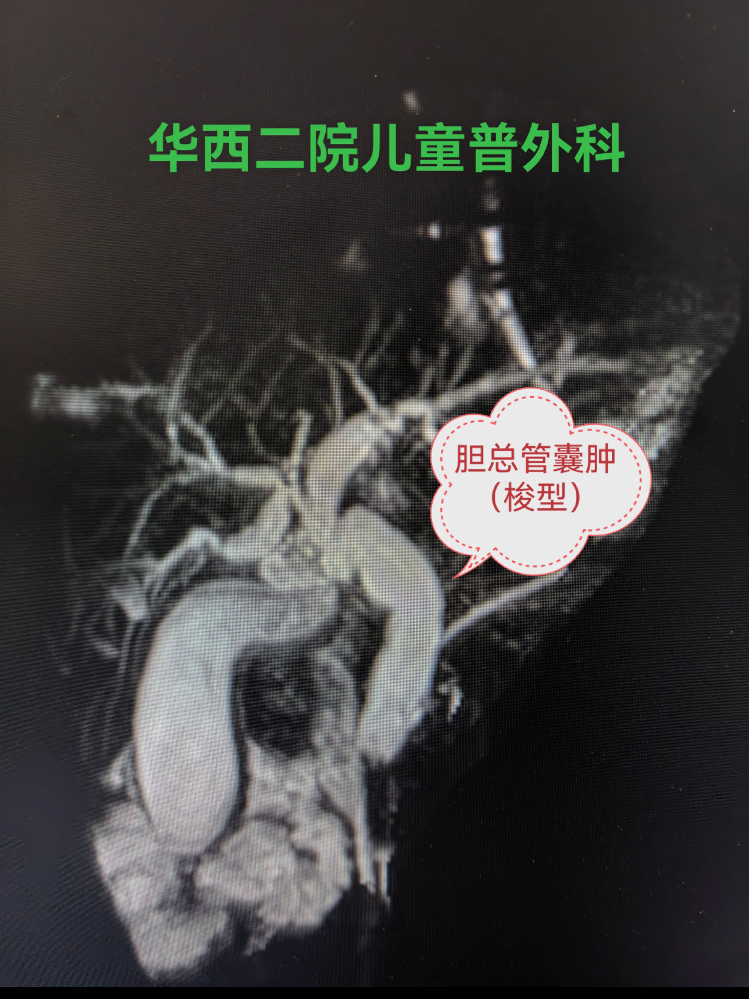  小儿外科举办关于新型冠状病毒防控的党建活动