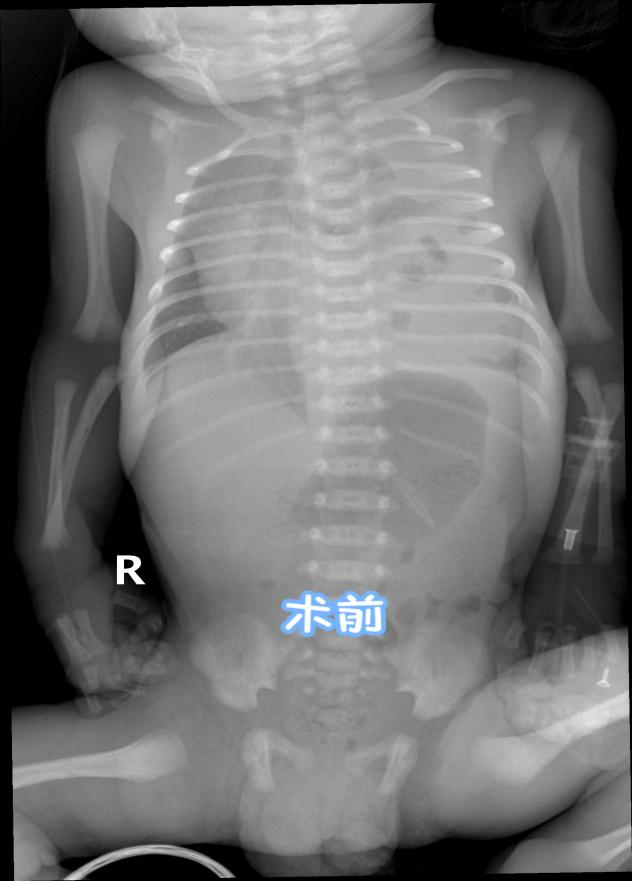  小儿外科举办关于新型冠状病毒防控的党建活动
